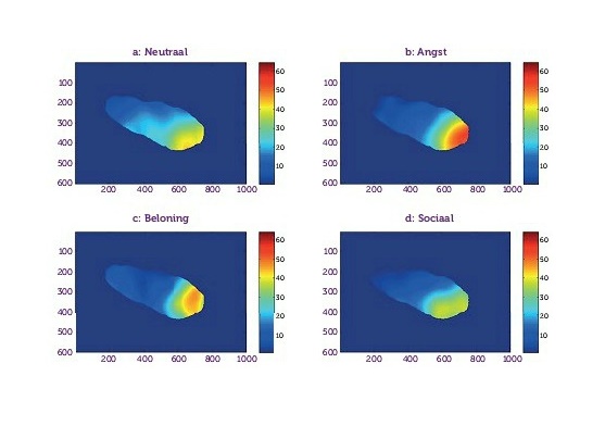 Klantgericht incasseren.